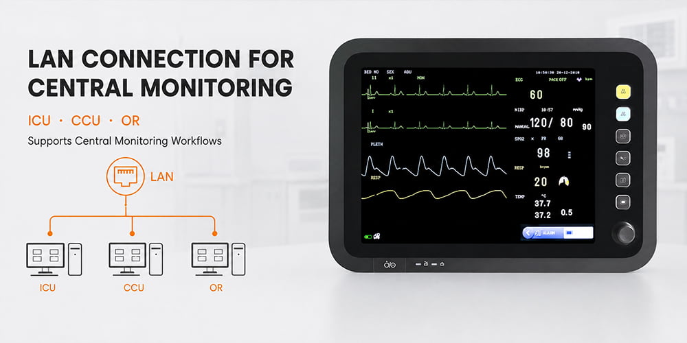 LAN Interface, Available with ICU,CCU,OR